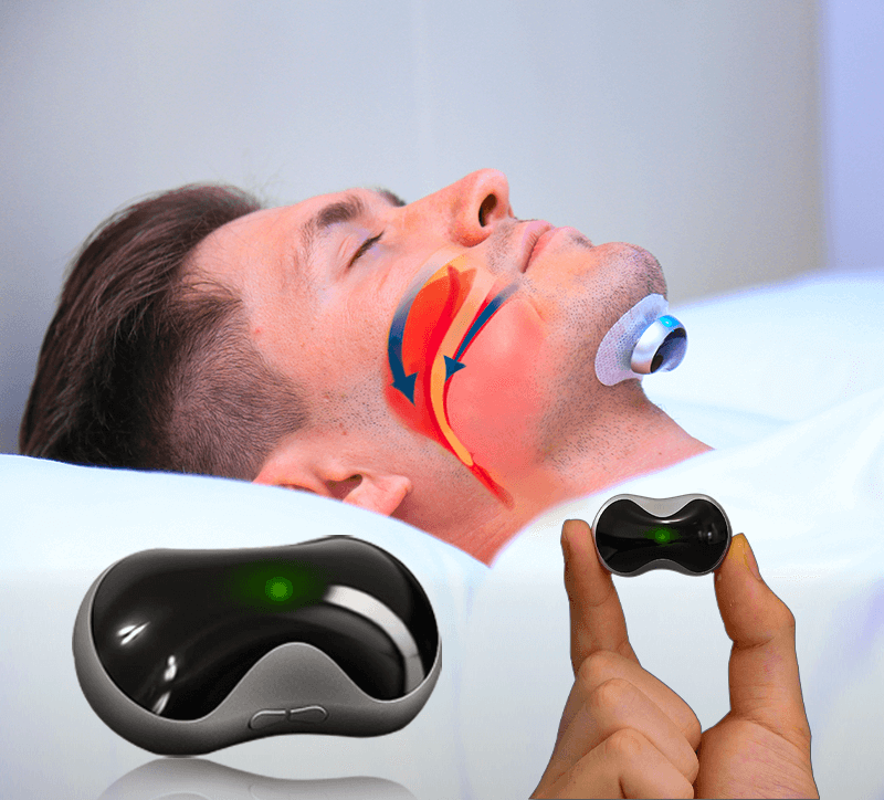 Rechargeable Anti-Snoring Device with Pulse Technology
