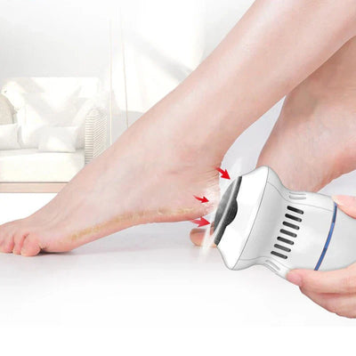 Rechargeable Electric Callus Remover with Vacuum