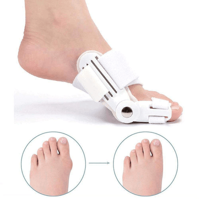 Hallux Valgus Corrective Splint – Adjustable Orthotic for Bunion Relief